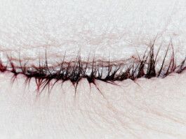 SICKY
